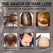 Rosemary Anti-loss Hair Growth - Boaties Collective